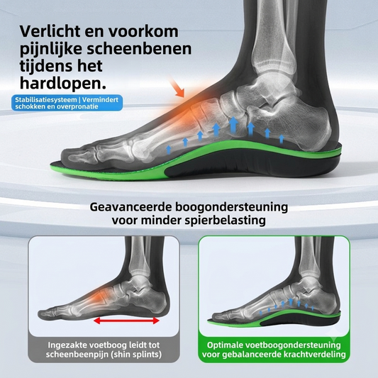Orthopedische Inlegzolen met Boogsteun – Tegen Scheenbeenpijn